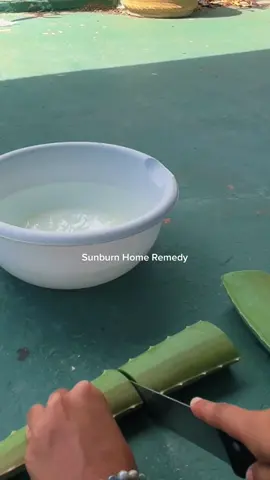 #sunburnhomeremedy #suntan #aloevera #lifehacks #fyp 