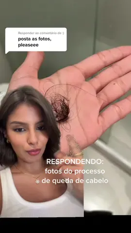 Respondendo a @:) resumo da minha historia com a queda de cabelo! Minha dica é sempre procurar um medico pra identificar a causa desde o inicio 🙌🏼 #fyp #quedadecabelo 