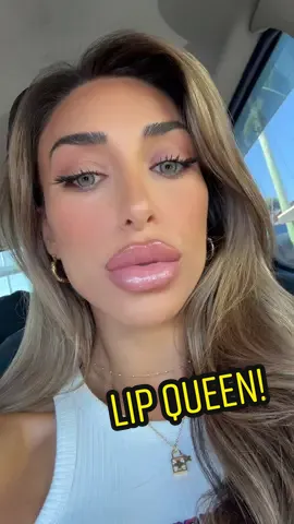 NO FILTER!! The incredibly tallented @Penny Polimenakos helped even out my lip ratio!! We hardly put anything in the bottom just focused on making the top one match a lil more!! ❤️❤️❤️ #lipfiller #fyp #trending #girl #VIRAL #lips 