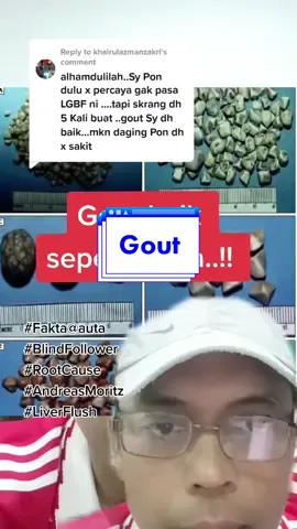 Replying to @khairulazmanzakri #gout #liverflush #gallstones #liverproblems 