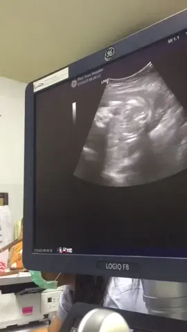 คนเก่งของแม่#ทีมกรกฎาคม #แม่เลี้ยงเดี่ยว 