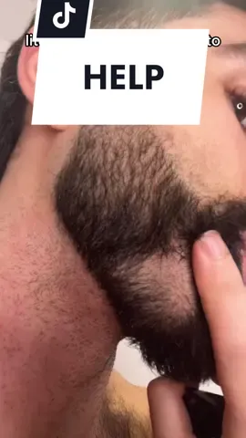 Help a brother out, what would you do? #fyp #Beard #BeardTrim #MensGrooming #beardtrouble 