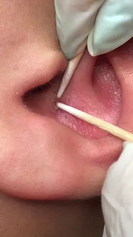 Um pequeno cravo dentro do ouvido 😅 #cravo #limpezadepele #videosatisfatorio #satisfyingvideo #fy #spa #relax #