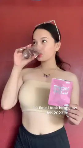 ANSWERING COMMON QUESTIONS ABOUT HOPEGLOW 💖 thank you @Luna Aura Hope Glow ! #hopeglowbylunaaura #whiteningproductsph #hopeglow💖 #hopeglowadvancedglutathione 