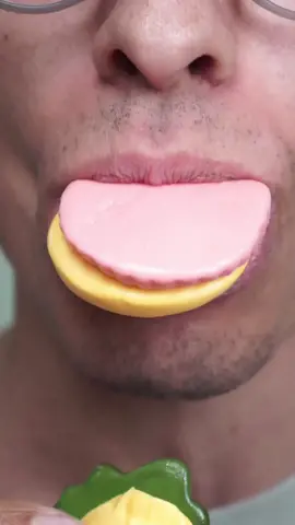 Krabby Patty vs braces #braces #bracestips #bracesoff #fyp #viral #food #candy #bracescolors #transformation #sour 