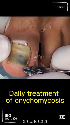 #pedicure #nails #foot 