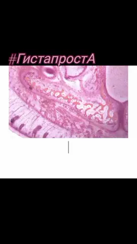 Куда проще? #гистологиячертвозьми #гистология🔬 #остеология #ткани #кость #гиста #тиктокпедия #учимся #гистапроста #челюсть 
