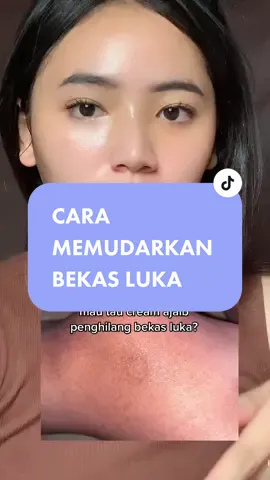 buat yang stres sendiri insecure gada abisnya gara gara koreng dimana mana ni pakein cream ini rutiiiin!!! #iboomingxsohibtiktok #iboomingsohibtiktok #iboomingxbioherbal #penghilangbekasluka #meilibeautycream #bioherbal #pemudarbekasluka 