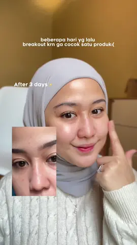 Gausah di tanya udah approved siihhh! #skinbarrierrepair #skinbarier 