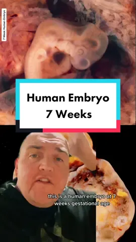 It is a miracle and a choice. And that’s okay. #womenshealth #embryo #anatomy #pregnancyjourney 