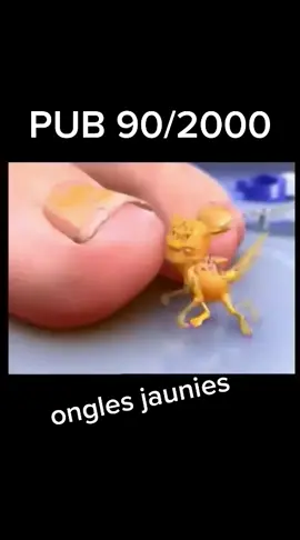#pub90 #pub2000 #novartis #novartispharma #onglejaune #onglesjaune #onglesjaunes #mycose #mycosedesongless 