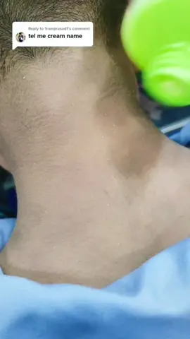 ينظف الرقبة السوداء بسهولة 💚 X.Q.M Face & Body Scrub Gel Remove Dead Skin #GlowANDclean #TiktokGaGa #Beauty #Foryou #Foryoupage #ameenbeautytips @Ameen Cosmetics Center 