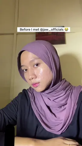 Skin saviour @White Egg Crystal Skin. Jom dapatkan skin raya yang cantik dengan #jawwhitetomato ! ❤️❤️ #skinsupplements #kulitputihsebelumraya   