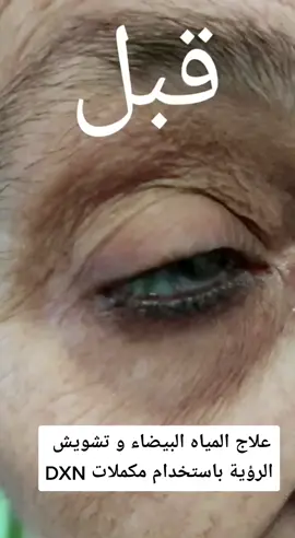 #للرجال #للنساء #بدون_هشتاق #علاج_طبيعي #مكملات #طبيعي 