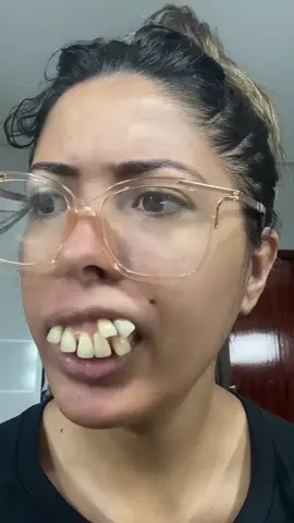 O que fazer agora? Aparelho resolve?😱