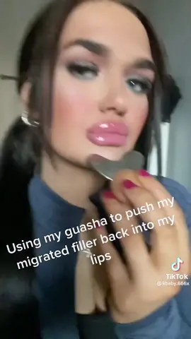 Sorry but it doesnt work :( #lipfillercheck #lipfillermigration #fillermigration #lipfillergonewrong 