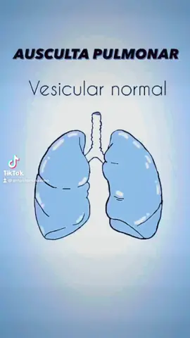 👉 @antonildesmaximo  Ausculta pulmonar é uma técnica do exame físico utilizada pelos profissionais da saúde para identificar os ruídos pulmonares geralmente usando um estetoscópio.⁣ ⁣ Sons pulmonares– representa o movimento do ar nos bronquíolos e alvéolos. São ouvidos em todos os campos pulmonares e são sons suaves e graves na inspiração longa e na expiração curta.⁣ ⁣ Roncos – são ruídos em ruflar (referidos como gargarejos), graves, intensos, e contínuos, audíveis na inspiração e na expiração. São produzidos, normalmente, pelo estreitamento da via aérea com secreção⁣ ⁣ Sibilos – são sons de característica musical (assobio) contínuos. São mais comuns na fase expiatória. Resultam da obstrução acentuada ao fluxo aéreo (vias estreitadas ou parcialmente obstruídas).⁣ ⁣ Estertores crepitantes: são ruídos finos, homogêneos, sendo auscultados apenas na fase inspiratória. São, também, denominados estertores alveolares, justamente porque são produzidos pelo deslocamento das paredes dos alvéolos, causados pela entrada de ar no seu interior.⁣ ⁣ Estertores subcrepitantes: são ruídos mais grossos e de tonalidade mais grave do que os estertores crepitantes, assemelhando-se ao arrebentamento de pequenas bolas. São encontrados o fim da inspiração e começo da expiração.⁣ ⁣ Estridor: é um som agudo ouvido melhor na inspiração, geralmente devido à obstrução do fluxo de ar na traqueia ou laringe. Indica fluxo turbulento nos brônquios, traqueia ou laringe. Pode indicar epiglotite, crupe, tumor, corpo estranho ou estenose/espasmo laringotraqueal. ⁣ ⁣ #repost @fisioterapia.hospitalar  ⁣ #fisioterapia #fisioterapeuta #auscultapulmonar #auscultation #auscultacardíaca #enfermagem #medicine #littmann #littmannbrasil #fisio #enfermagem #pneumologia #pneumo #fisiocardiorespiratoria #fisiorespiratória 