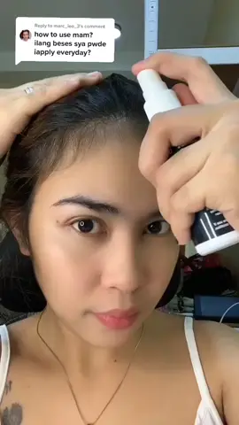 Replying to @marc_leo_3 spray nyo lang sa scalp sa part na maliit yung hair. You can use it everyday 2x a day. Morning and evening 🥰 Click yellow basket to order po. Thank you 😇 #minoxidil #minoxidilstrands6 #minoxidilstrandshairregrowthtreatment #foryoupage #fypシ 