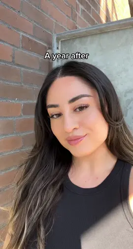 I hope this video will be helpful to other women who are considering a hair transplant🫶🏼 Over the years I had lost hair in my hairline which I was really sad about.  #femalehairloss #femalehairtransplant #hairtransplant #denmark #womenshairtransplant #fyp 