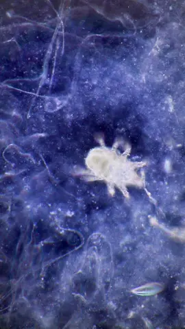 Look what I found in a rotten cucumber 🥒  I was performing some fungal isolations and I found this #invisibleworld. Its really incredible how complex can be microscopic life😁😁 Thank you @bresser_europe for this new tool that help me improving my invisible worlds exploration  This video is made using my:  Sony Alpha 7R  Nexscope NE620T  #microscope #macro #cucumber #rotten #fruit #vegetables #Science #biology #learn #school #invisible #invisibleworld #insects #worms