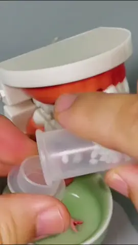#temporarytooth #resintemporarytooth #toothrepairkit #toothrepairbeads #toothrepair 