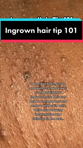 #galaxyextraction #ingrownhair 