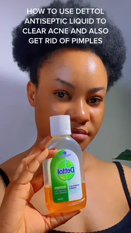 How to use Dettol Antiseptic Liquid to treat pimples and clear acne. Please wash it off 2 to 3 mins after application #tiktok #tiktokgh #trend #foryou #foryoupage #fyp #fypシ #fyppppppppppppppppppppppp #skincare #skincareroutine #treatacne #skincaregame #pimpleremover 