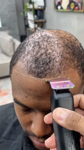 Barbers and Stylists in El Paso, listen up! Want to learn the latest technique that can help your clients with thinning hair, alopecia, or baldness? DM me for details on how to offer custom hair units and triple your income! Limited slots available, act fast! #CustomHairUnits #ManWeaves #HairLossSolutions #ElPasoBarbers #TexasBarbers #SouthwestBarbers #ThinningHair #BaldingMen #AlopeciaAwareness #ForYou #Barber #Reels #ExplorePage