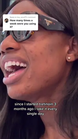 Replying to @hey_jess27 click the link in the bio for sample calorie deficit meal plans to start your weight loss journey the right way for the last time 