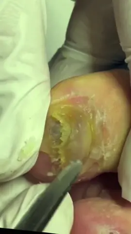 #nails #foot #fyp #foryou 