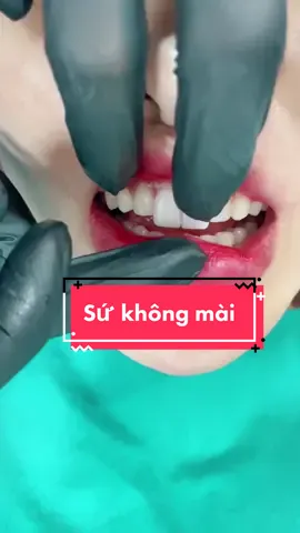 Dán sứ không mài được mà. Tin bác sĩ đi. #dansu #veneers #rangsu #bacsi 