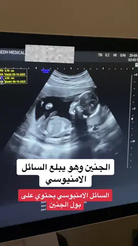 شفتوها لحركة البلع المتكررة #dr_seba_hammadeh #gynecologist #obstetrician #ultrasound #qatar🇶🇦 #نسائية_وتوليد #دكتورة_صبا #pregnancy #baby 
