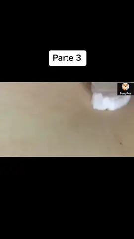 #asmr #espremerespinha #fly #viral #espinhas #satisfatorio #pimple 