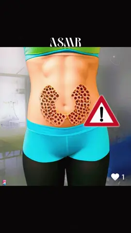 Remove maggots from the abdomen#fyp #foryou #animation #asmr #health 