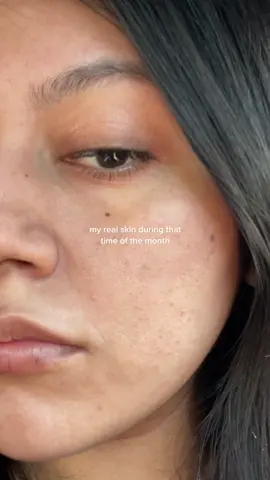 #realskin #relatable #skintok 