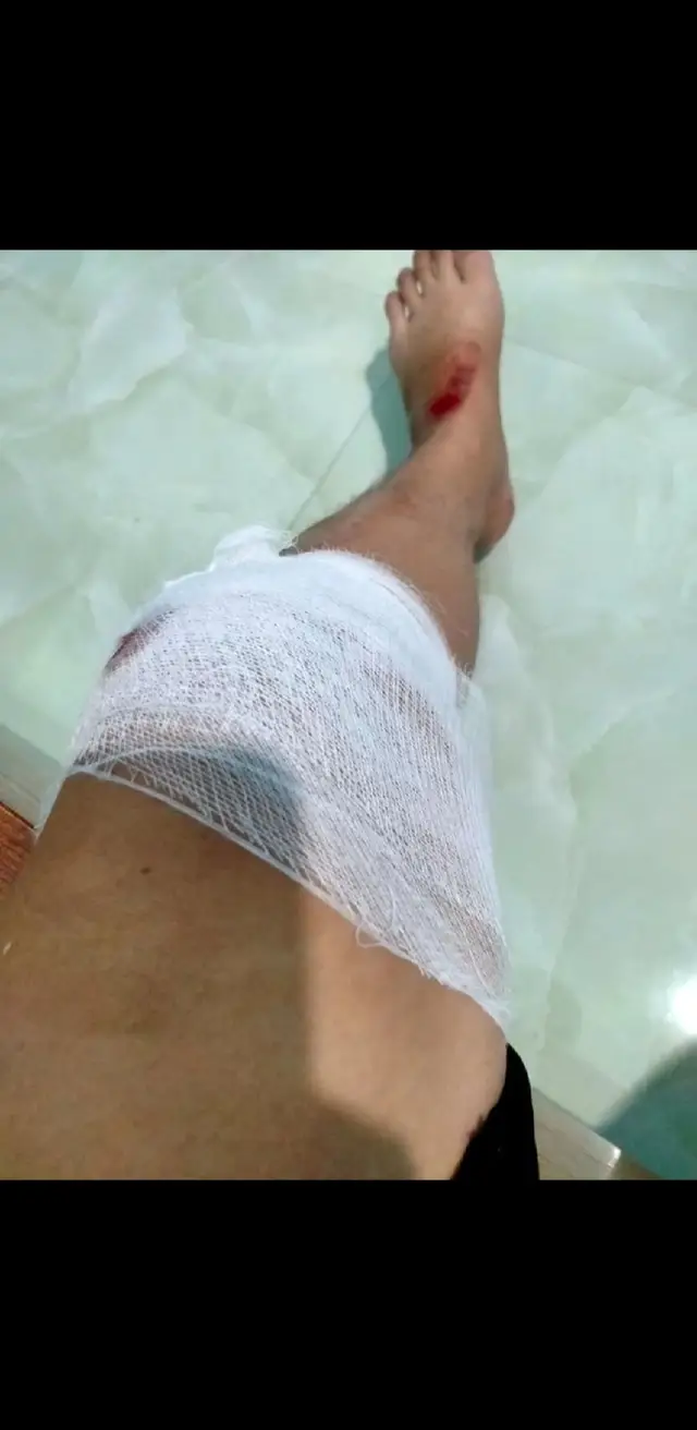 Mọi vết thương về thể xác đã không thể làm đau 1 người đã chai sạn về cả con tym và tâm hồn #tamtrang #TikTokGiaiTri #xuhuong #fyp #chàngtrai17tuổi #taoladuc0910 