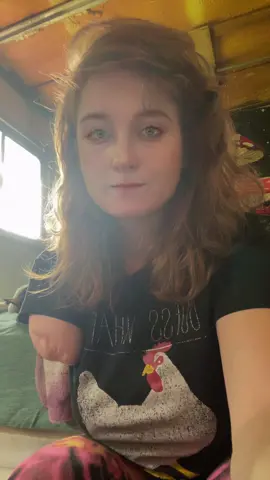 #soexcited #prostheticarm #the1rmdbndt #amputeelife #fypシ #fyp #amputeetiktok #onearm 