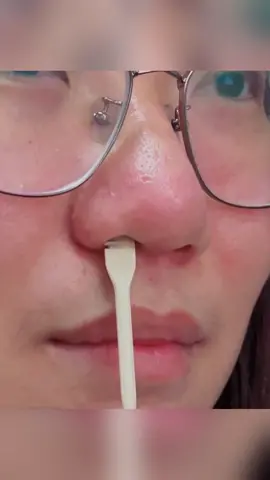 #TikTokMadeMeBuyIt #With this #Nose Hair knife, you won't be afraid to expose your nose hair too embarrassing #obsessive-compulsive must-see #Nose Hair Cleaning#goodthings #sharing #hottrend #fypシ #foryoupage #foryou 