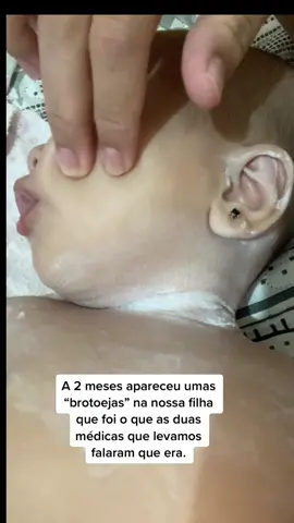 Um relato! Foi muito difícil enquanto achavamos que era uma simples “brotoeja” pois ela chorava bastante coçando e não podia um pouco se quer no ar livre pois começava a aparecer mais e mais bolhas. Graças a Deus quando descobrimos o que realmente era começamos a tratar da forma correta. QUE ALIVIO, em ver nossa filha bem 🙏🏼🥹❤️ #paidemenina #mel #relatodeumpai 