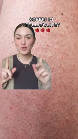 Guanti esfolianti 🧤 Ne trovi tantissimi su Amazon, ho messo alcuni link nelle stories in evidenza su ig che si chiamano 