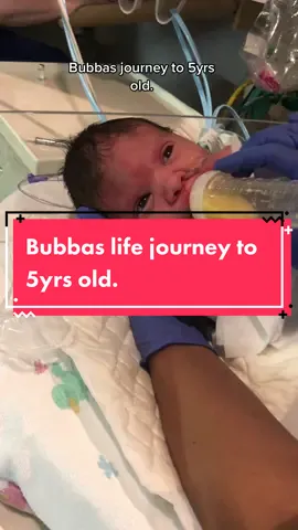 Bubbas journey to 5yrs old. #fyp #daddysboy #spinabifidawarrior #trachbaby #birthdayboy #bubbastrong #scoliosis #godsgift #spinabifida #paraathlete #wheelchairathlete #4yroldsontiktok #familytok 