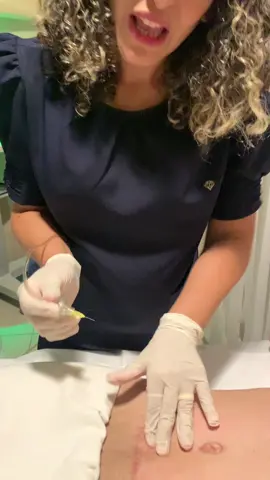 Voce ja conhece a carboxiterapia? Ai ela esta sendo usada para melhorar a fibrose no pós operatório. ✨🥰 #draolgavieira #stetic #padraovv #drvalderivieira #skincare #resultado 