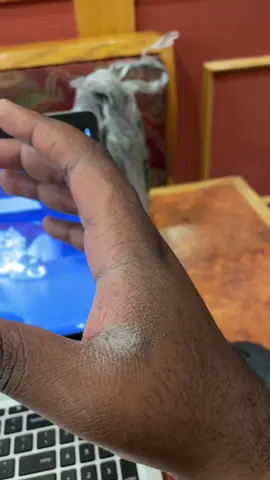 Unsolved Black mysteries file: 175 #fyp #trending #relatable #ash #moisturizer #lotion #dryskin #dryskincare #dryskincareroutine 