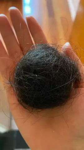 #CapCut Hair loss solve #fyp #styletips #foryou #haircare #welldone