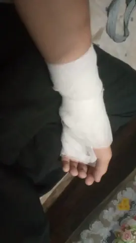 Hand bone 🦴 is broken 🥺💔