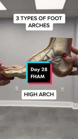 Day 28: These are the 3 types of foot arches 🦶 #Aetrex #FHAM #FootHealthAwarenessMonth #PF #Hack #Flat #Medium #High #Feet