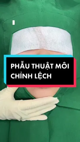 Case Chỉnh môi tim vĩnh viễn, Môi lệch không đều nhau. Môi trên dày - môi dưới bị trề. Làm gương mặt già hơn và thiếu sự thanh thoát! 👄#THUYBEAUTYCENTER 