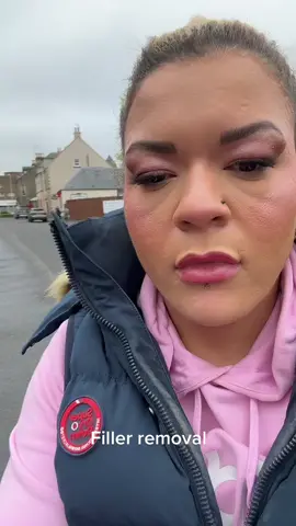 Lips no more!!! #fyp #BeautyTok #fyp #lipfillers 