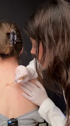 ASMR point pressure therapy acupressure pain relief @chilib_asmr #asmrchiropractic #asmrback #asmrvideo #asmrshouldersmassage #asmrshoulders #asmrrealperson #asmrmedicalroleplay #asmrmedicalexam #asmrsensory #asmrdoctorroleplay #asmr_tingles #asmracupressure 