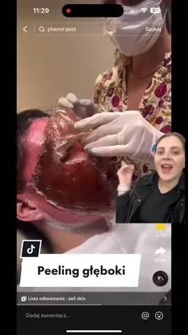 #greenscreenvideo alyszales o tym zabiegu? #kosmetyki #pielegnacjatwarzy #skincare #kosmetolog 